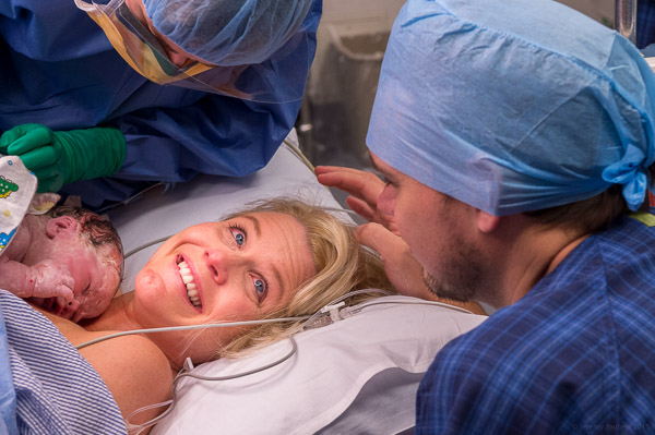 Maternal Assisted Caesarean Sections