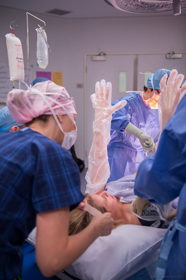 Maternal Assisted Caesarean Sections